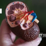 CKD